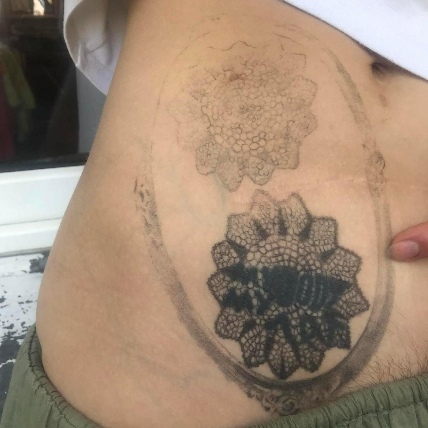 Inksearch tattoo szczypie